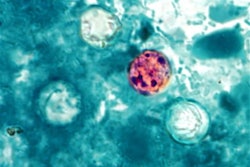 Mnet 30602 Cyclospora