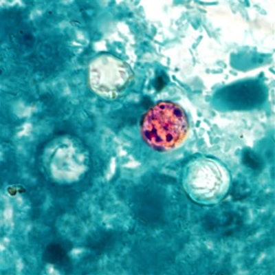 Mnet 30602 Cyclospora