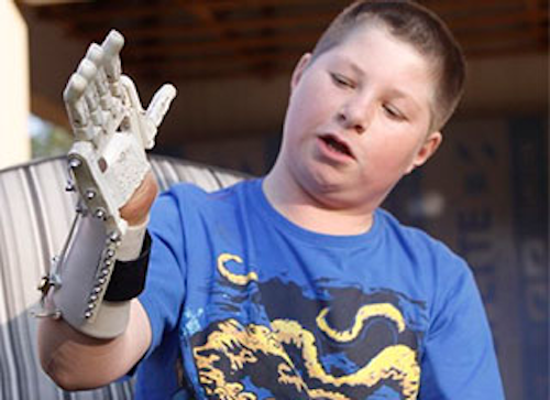 Mnet 161022 Robohand
