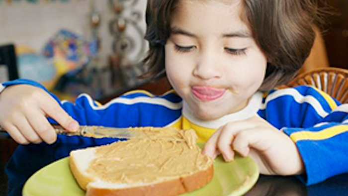 Mnet 137891 Peanut Allergys2 Lead