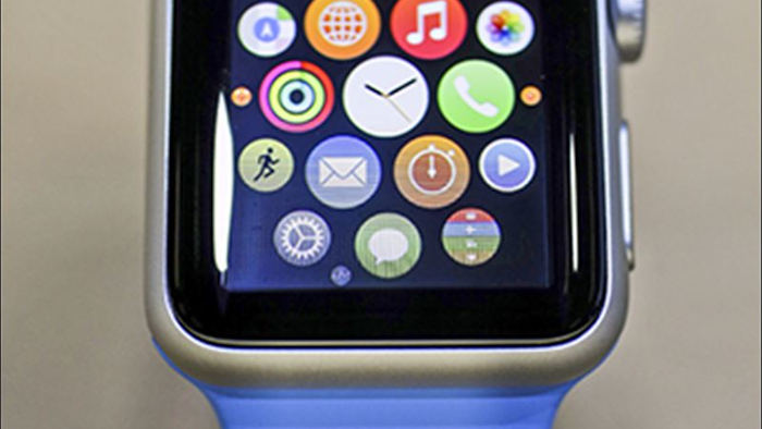 Mnet 168235 Apple Watch 1