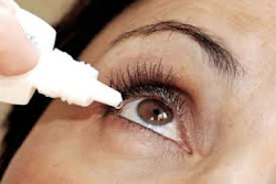 Mnet 122266 Eyedrops