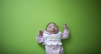 Sophia, who is two weeks old and was born with microcephaly, sleeps before her physical therapy session at the Pedro I hospital in Campina Grande, Paraiba state, Brazil, Friday, Feb. 12, 2016. The Zika virus, spread by the Aedes aegypti mosquito, is suspected to be linked with occurrences of microcephaly in new born babies, but no link has been proven yet. (AP Photo/Felipe Dana)