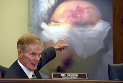 While speaking during a Senate Commerce, Science, and Transportation Committee hearing in Washington, Sen. Bill Nelson, D-Fla., points to the injury on a victim who was hit by shrapnel when a car's Takata air bag inflated. (AP Photo/Susan Walsh, File)