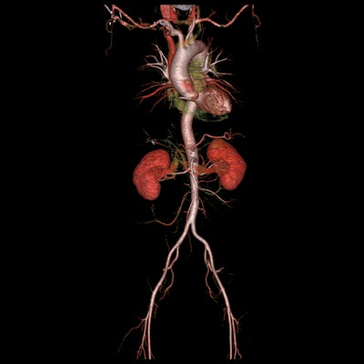 This image of the kidneys was captured by GE’s Revolution CT scanner. (Image credit: GE Healthcare)