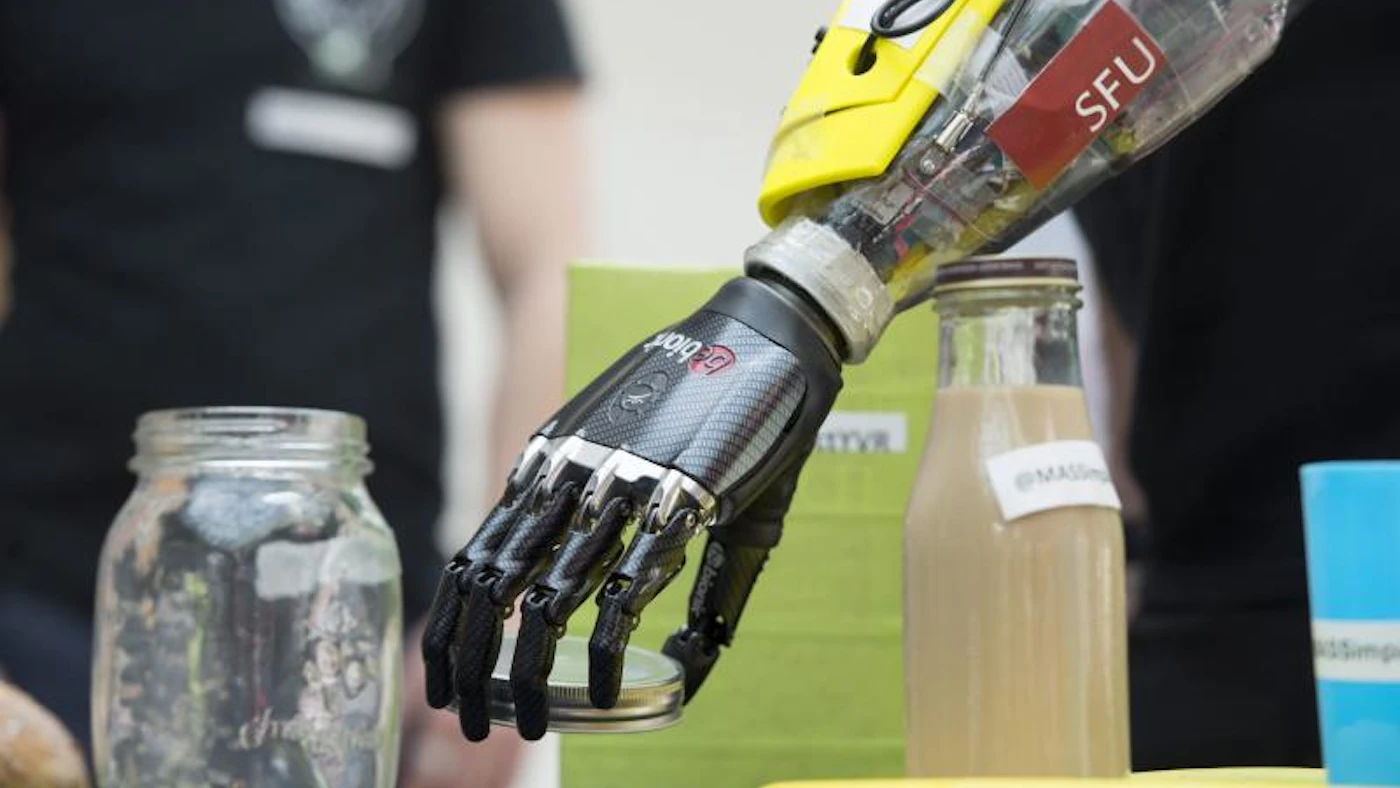 Photos of the Day: Bionic Hand Developed For World's First Cyborg ...