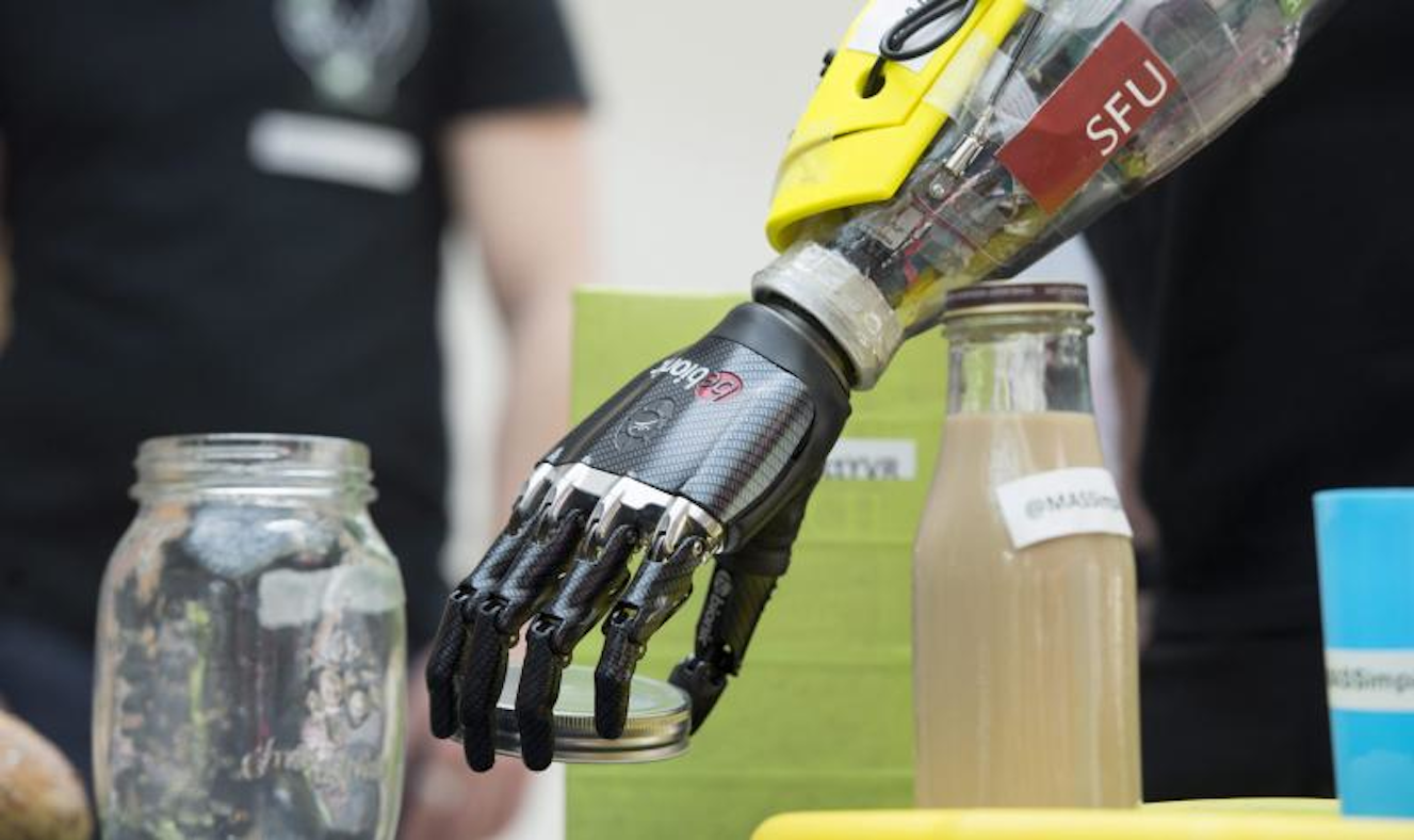 Photos of the Day Bionic Hand Developed For World's First