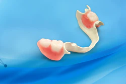 Mnet 125330 Solvaydental