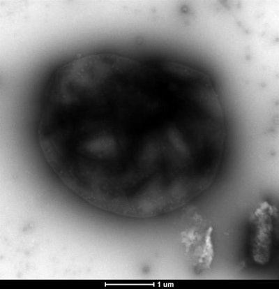 Transmission electron microscopy image from Thomas Wood's laboratory of their engineered M. acetivorans strain capturing methane.