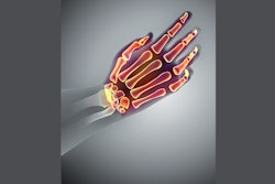 Mnet 174906 Cpt9196 Havs Advice Image 1