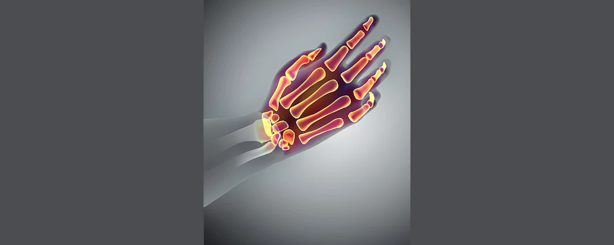 7 Tips To Protect Workers From Hand Arm Vibration Syndrome | Manufacturing.net 7 Tips To Protect Workers From Hand Arm Vibration Syndrome | Manufacturing.net