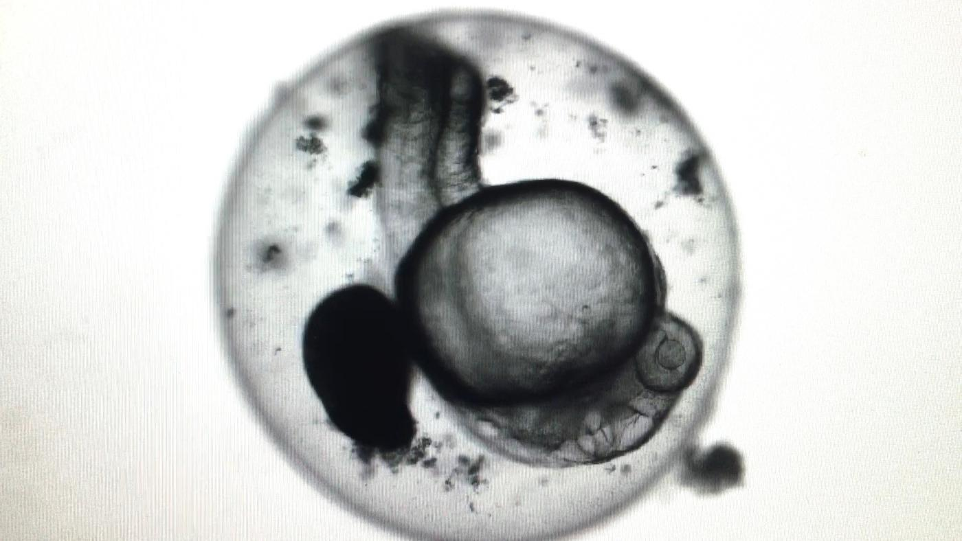 Mnet 125746 Fishembryo