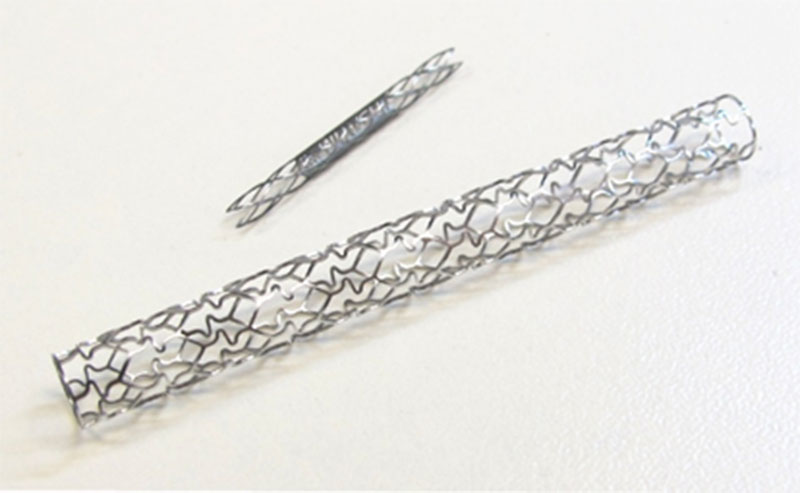Figure 1: Examples of common features in modern stents