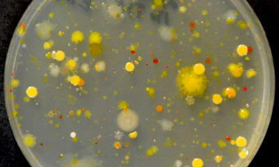 A representative agar plate illustrating the great diversity of bacteria that colonize tomato leaves in an agricultural field. Each spot is a growing colony of bacteria that was washed off a tomato leaf. (Elijah Mehlferber, Koskella Lab/UC Berkeley)