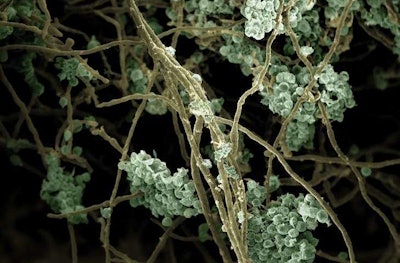 When scientists place the organisms in the same environment, the algae (green) attach to the fungi (brown). (Zhi-Yan Du and Igor Houwat/MSU-DOE Plant Research Laboratory)