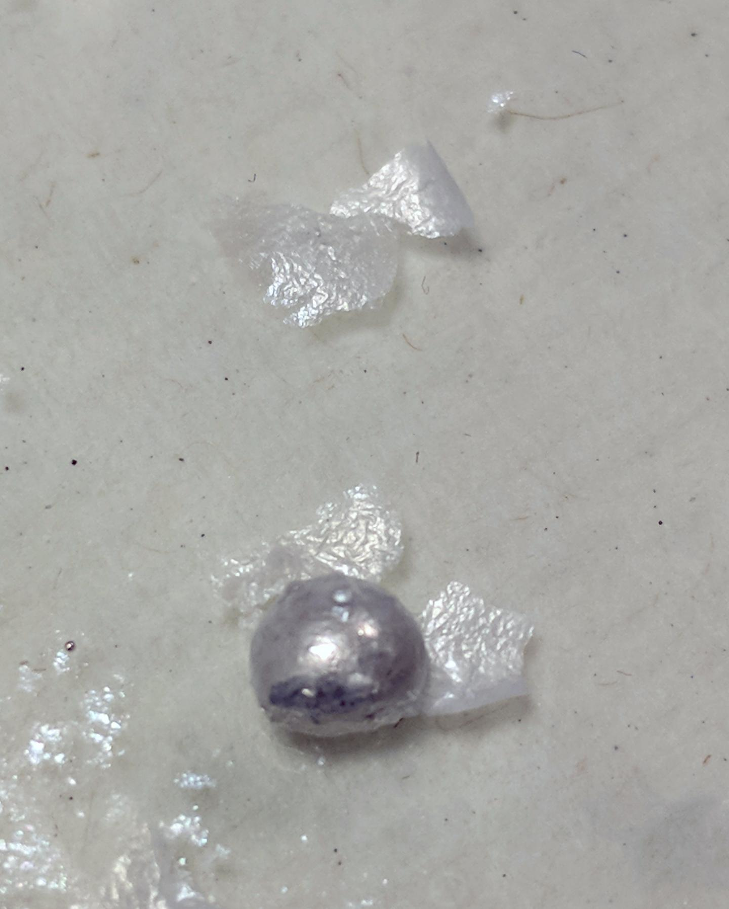 A liquid metal droplet with flakes of aluminium oxide compounds grown on its surface. Each 0.03mm flake is made up of about 20,000 nano-sheets stacked together. (RMIT University)