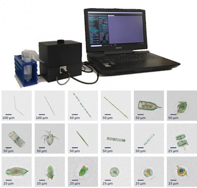 UCLA's imaging flow cytometer is powered by deep learning. (Zoltan Gorocs, Miu Tamamitsu,Vittorio Bianco, Patrick Wolf,Shounak Roy, Koyoshi Shindo, Kyrollos Yanny, Yichen Wu, Hatice Ceylan Koydemir, Yair Rivenson & Aydogan Ozcan)