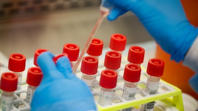 In this March 11 photo, a technician prepares COVID-19 coronavirus patient samples for testing at a laboratory in New York's Long Island. Wide-scale testing is a critical part of tracking and containing infectious diseases. But the U.S. effort has been plagued by a series of missteps, including accuracy problems with the test kits the CDC sent to other labs and bureaucratic hurdles that slowed the entrance of large, private sector labs.