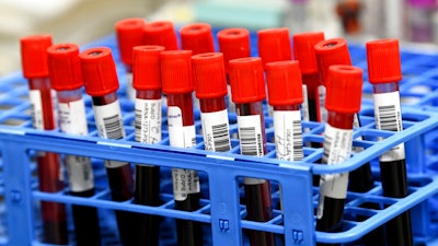 Blood samples from volunteers participating in the last-stage testing of the COVID-19 vaccine by Moderna and the National Institutes.