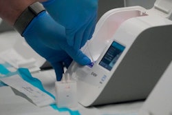 Rapid tests like the Abbott ID Now require only small, portable machines and can give results in 15 minutes, but they sacrifice accuracy.