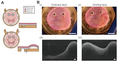 The new anchoring method allows flexible skin tissue to conform to any shape it’s attached to. In this case, a relatively flat robotic face is made to smile and the skin deforms without constraining the robot, returning to its original shape afterwards.