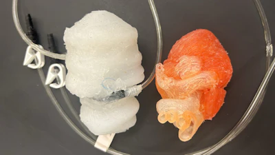Two 3D-printed heart models. The white one replicates the left two heart chambers with a pneumatic actuator that makes it “beat.”